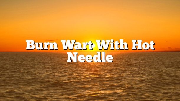 Burn Wart With Hot Needle