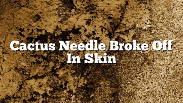 Cactus Needle Broke Off In Skin