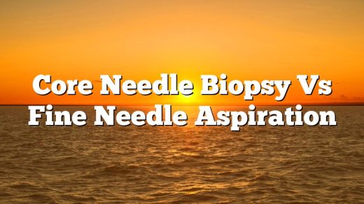 Core Needle Biopsy Vs Fine Needle Aspiration