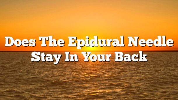 Does The Epidural Needle Stay In Your Back