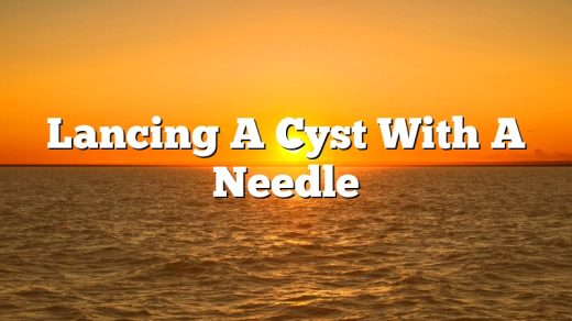 Lancing A Cyst With A Needle