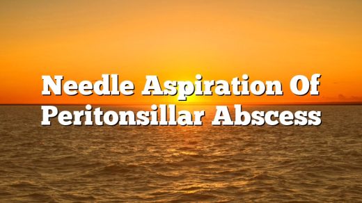 Needle Aspiration Of Peritonsillar Abscess