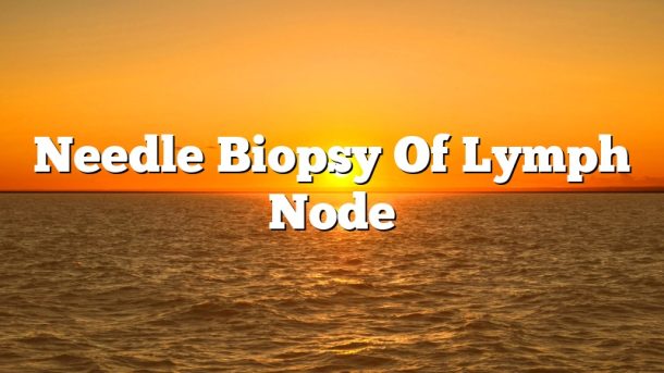 Needle Biopsy Of Lymph Node