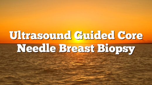 Ultrasound Guided Core Needle Breast Biopsy